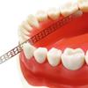 150 mm Dental Metall Reinigungsstift Streifen Polieren Zahnarzt Bleaching Materialien mit Loch Dental Metallstreifen für die Reinigung