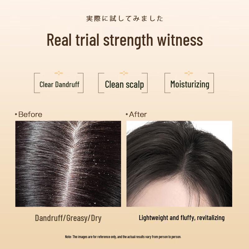 Dieyin Horse Oil Anti-Dandruff & Anti-Itch Shampoo