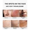 Whitening Cream  Fade Spots Blackheads Melanin Moisturizing Brightening Soft Smooth Firming Skin Care