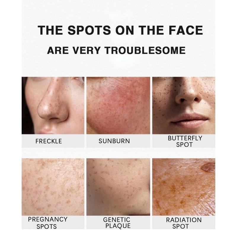 Whitening Cream  Fade Spots Blackheads Melanin Moisturizing Brightening Soft Smooth Firming Skin Care