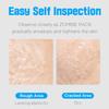 SKIN1004 Zombie Pack Activator Kit, Egg White Albumin, Exfoliate Dead Skin Cells, Brighten Dull Complexion, Korean Cosmetics, Korean Skincare