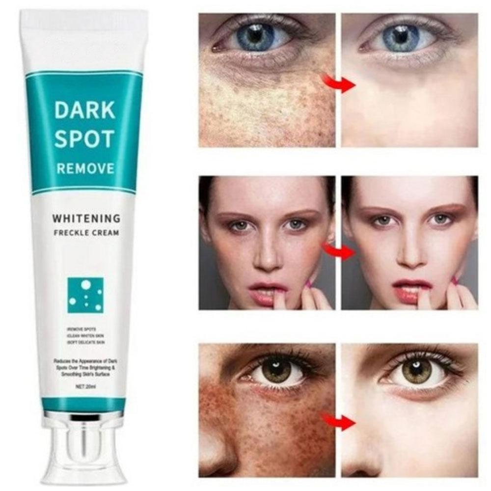 SMIATEY 1+1 Age Spot Removal Vita e Whitening Cream Crème Taches de vieillesse Imperfections 20 ml 1 unité, 2 contenants, 20 g