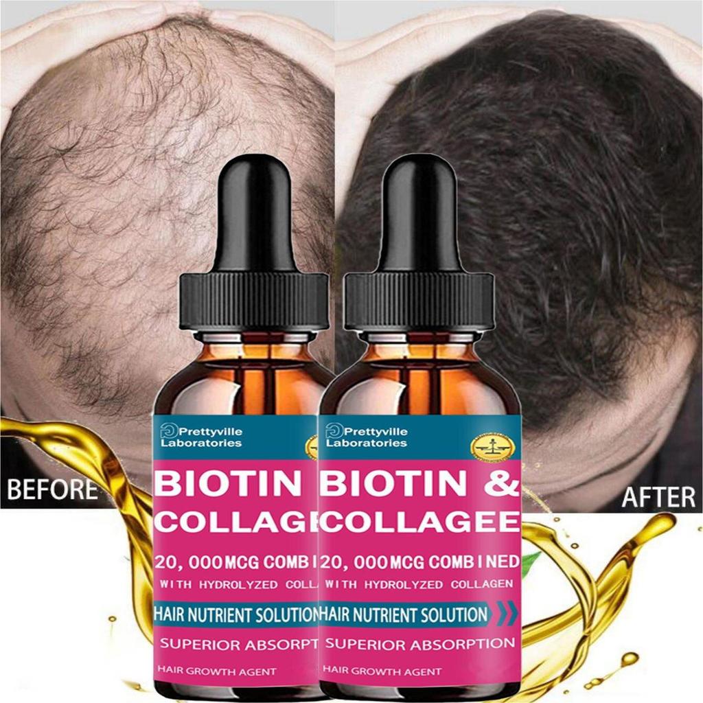 Indian Mysterious Formula Hair Growth Oil for Women Men Hair Grow Spray Fast Anti Hair-loss Head Skin Care