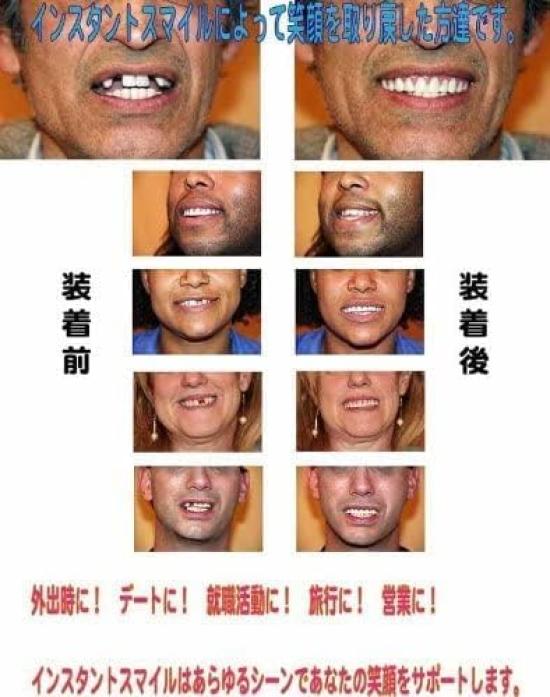 Zâmbet Instant Mărime M Articol Unic (Zâmbet Instantaneu)