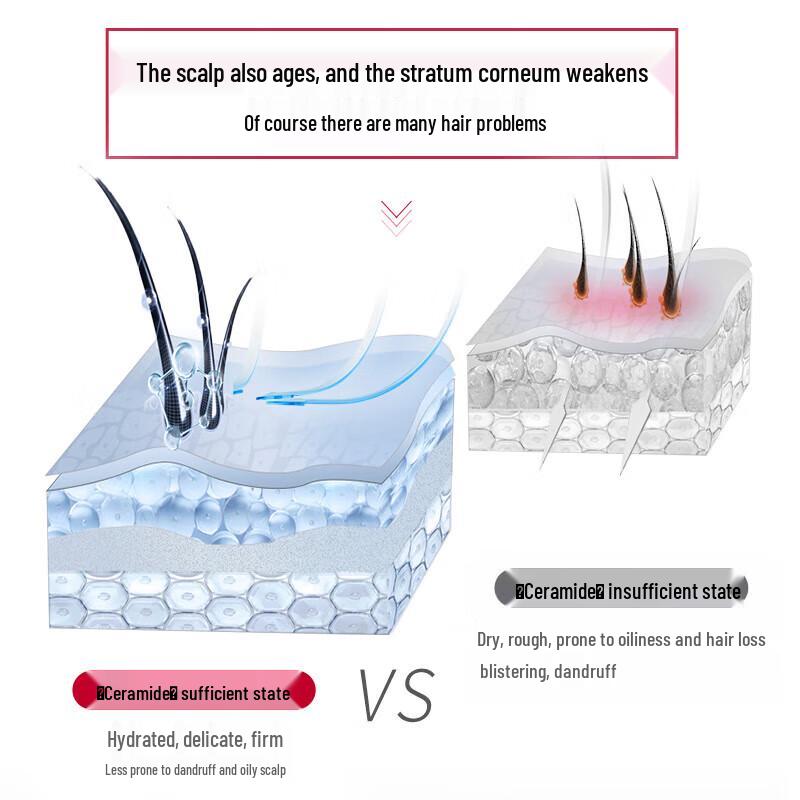 SLEK PRO Scalp Refreshing Anti-Dandruff & Oil Control Shampoo