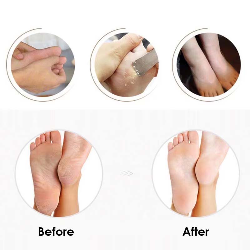 Professional Hot Sale Pedicure Planer USB Charging Foot Callus Remover Foot Grinder Replacement Head Foot Callus Remover