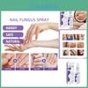 Spray Jaysuing para Cuidado de Uñas Grises Para Uñas de los Pies Suaves y Gruesas con Fórmula de Limpieza Profunda