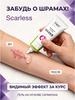 Gel for Scars and Scars