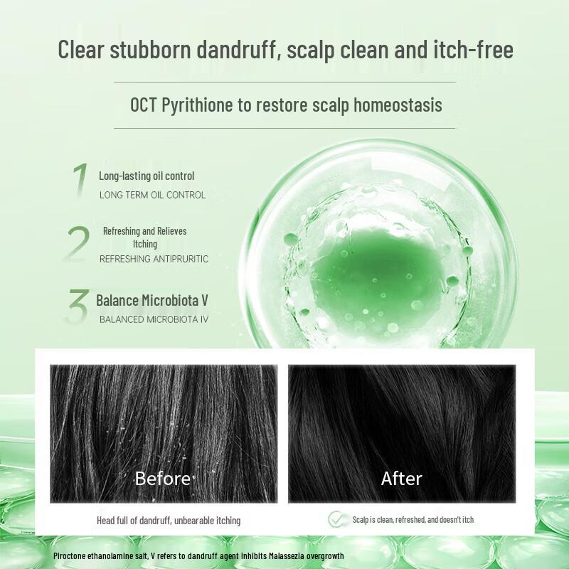 Yujie Oil Control & Anti-Dandruff Men's Shampoo