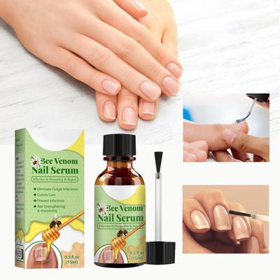 Bienengift Nagelserum - Nagelverteidigung Bienengift-Behandlungs Serum Pro, Bienengift Nagelbehandlung Serum, Bienengift Nagelbehandlungs Serum 15ml