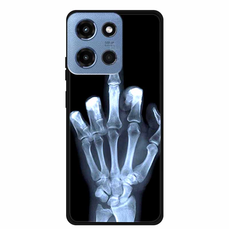For Motorola G 5G 2025 Case Bumper Soft TPU Silicone Back Cover Cartoon Phone Cases For Motorola Moto G 5G 2025 Fundas Coque