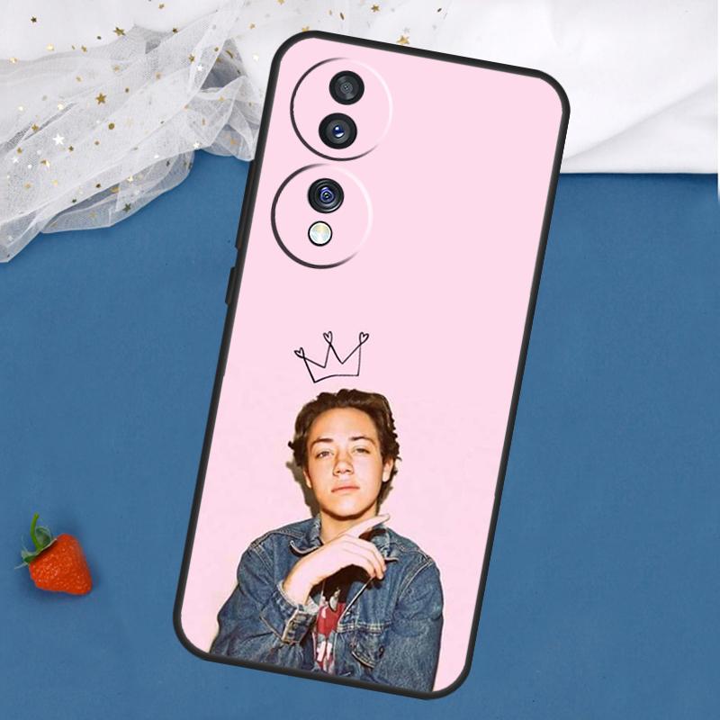 

Cute Carl Shameless Case For Honor Magic 8 5 6 7 Pro 200 400 50 70 90 Lite Win RT X8c X8b X9a X9b X9c X9d Cover Honor X8b