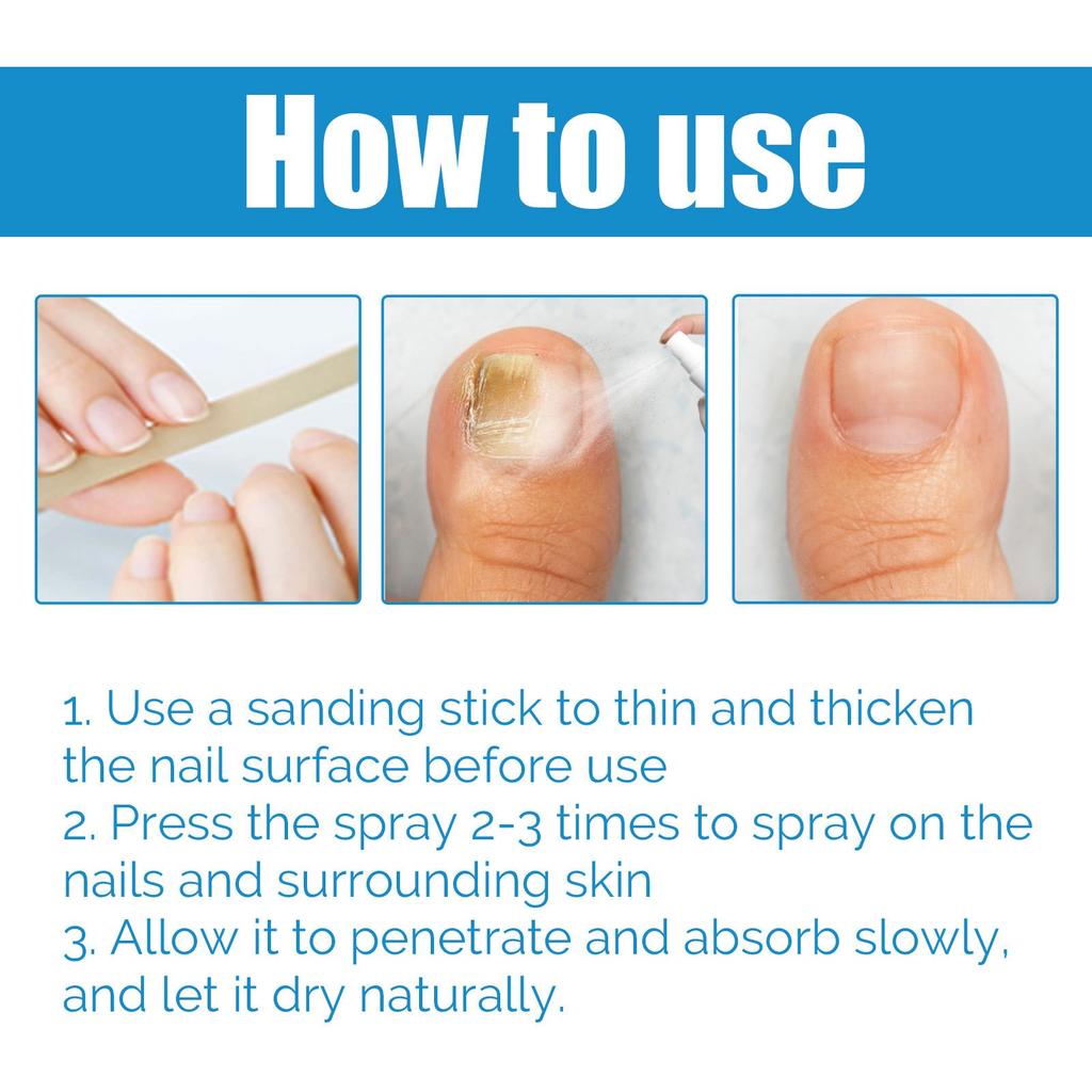 Spray pour Soin des Ongles Nourrit la Peau et les Ongles, Améliore l'Apparence et l'Odeur, 100ml