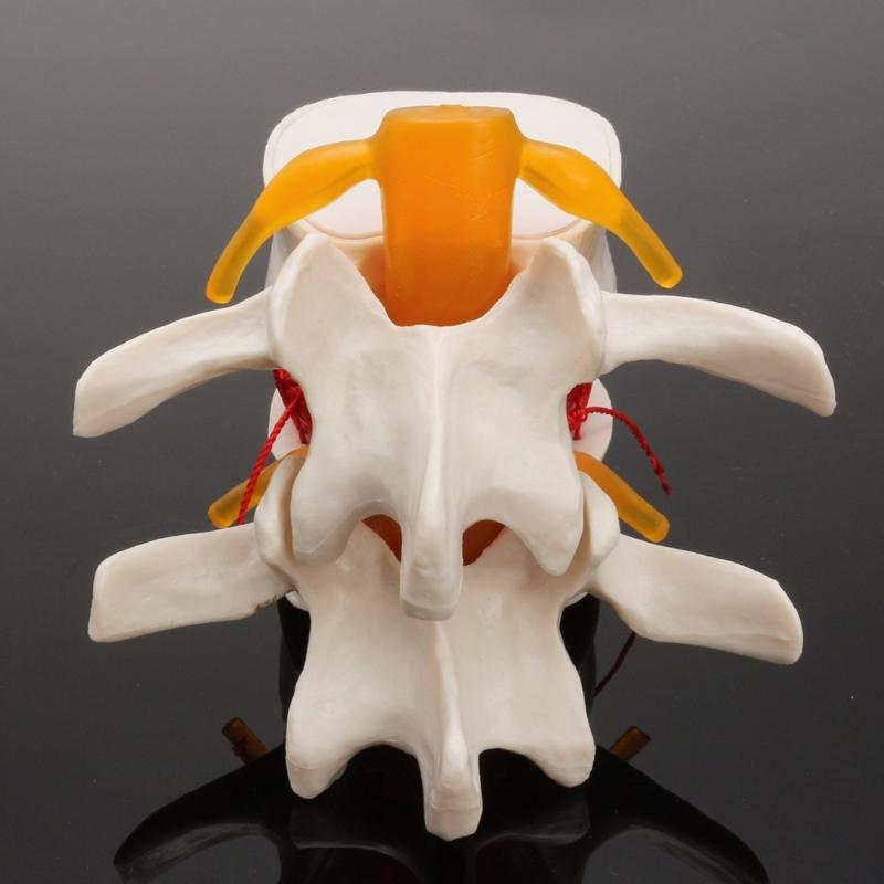 Human Anatomy Skeleton Spine Lumbar Disc Herniation Brain Skull Model Traumatic Pistol Medical Teaching Instrument for School