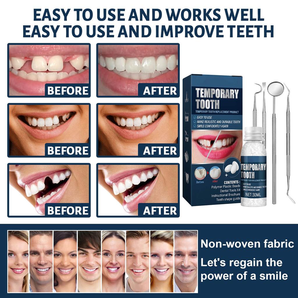 30ml Moldable Teeth Glue 4 Dental Tools Temporary Tooth Filling Set Difficult to Deform Smile Confidently
