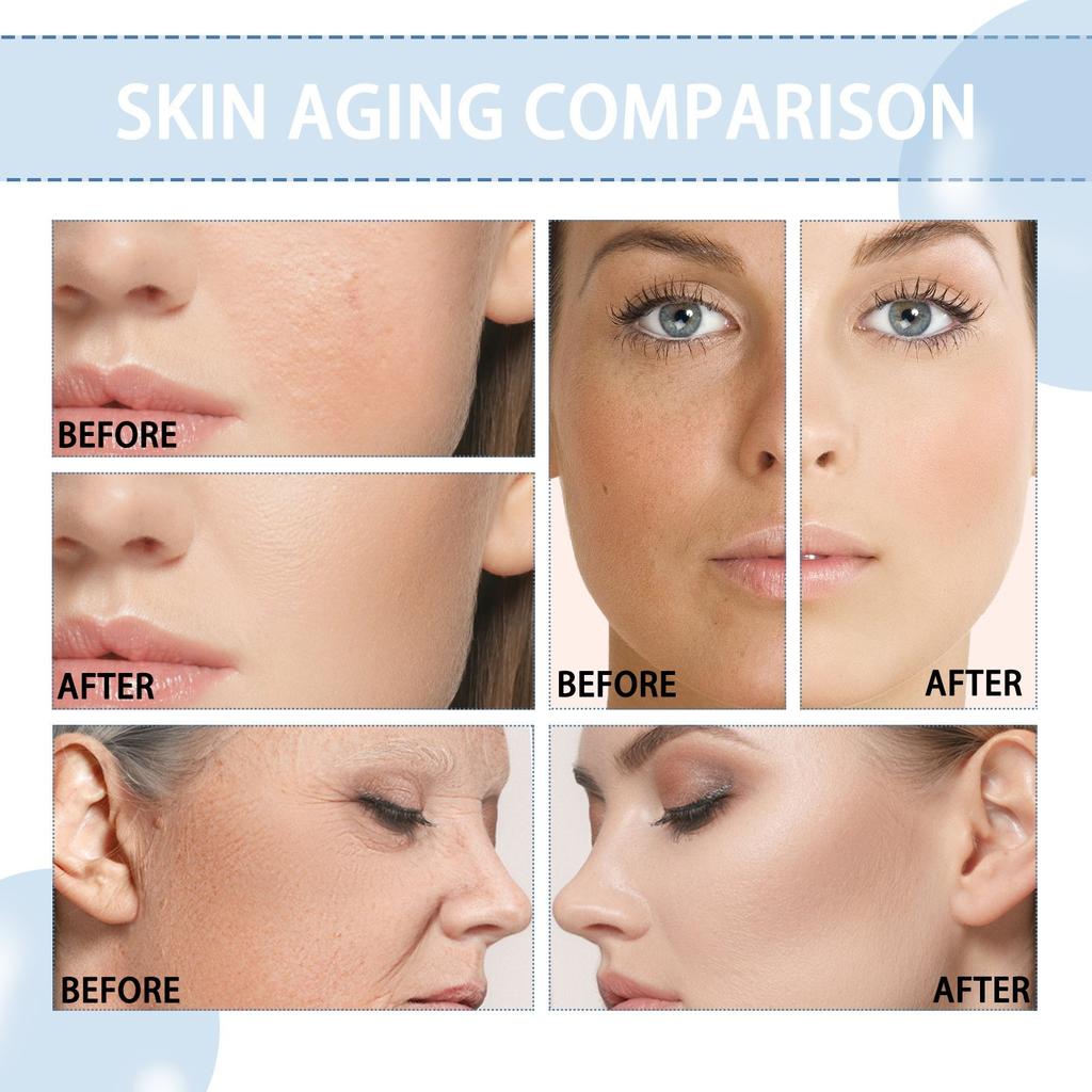 Niacinamide Serum Reduce Fine Lines, Nourishing And Moisturizing Care. Dull Skin, Whitening Aging Serum, Moisturizing And Wrinkle Serum,30ML/1.8 Floz