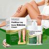 Leg Relief Edema Cream, Anti-Swelling, Reduces Edema & Puffiness, Leg Therapy Cream, 1pcs