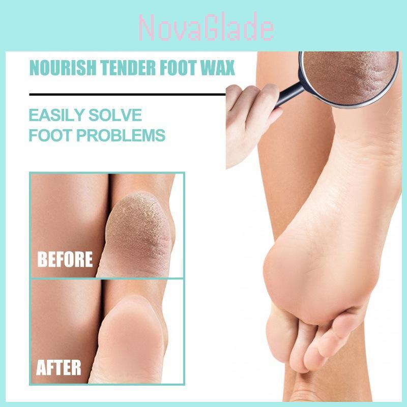 Ouhoe Moisturizing Foot Cream For Dry Cracked Heels And Rough Skin Repair 100g