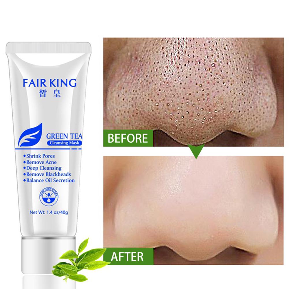 blackhead deep cleansing