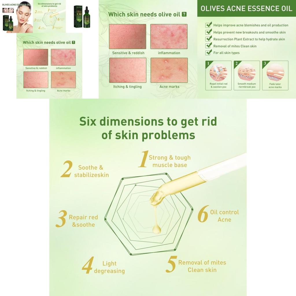 Jaysuing Essential Oil For Gentle Moisturizing And Acne Scar Repair 30ml