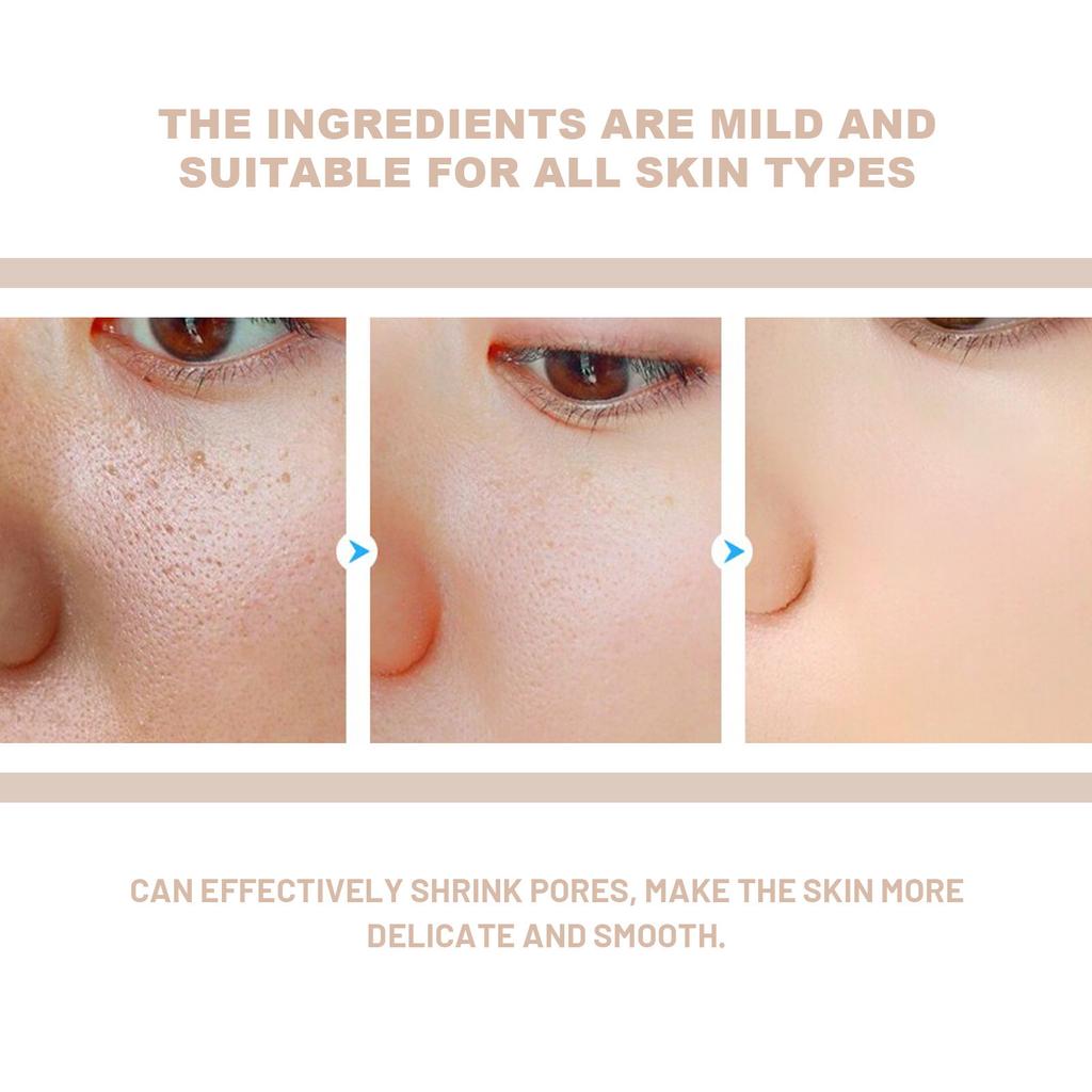 Peeling-Gel Porenverkleinernd Reparatur Rötungen Tiefenreinigung Entfernt Abgestorbene Haut Dunkle Flecken Aufhellend Feuchtigkeitscreme Peeling Gesichtspeeling
