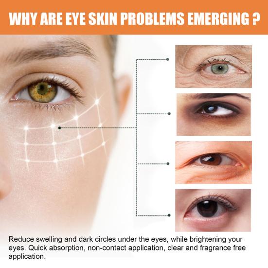 Vitamin-C Eye Stick for Dark Circles 4ml Anti-Wrinkle Eye Cream for Fine Lines & Puffiness Firming Hydrating under Eye Treatment