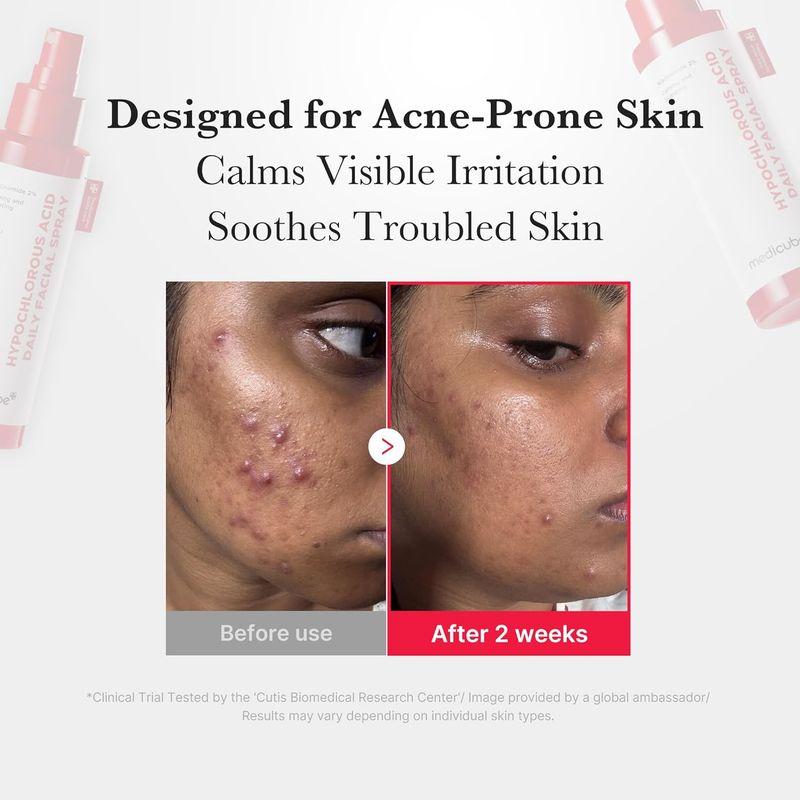 [MEDICUBE] Hypochlorous Acid Daily Facial Spray 50ml