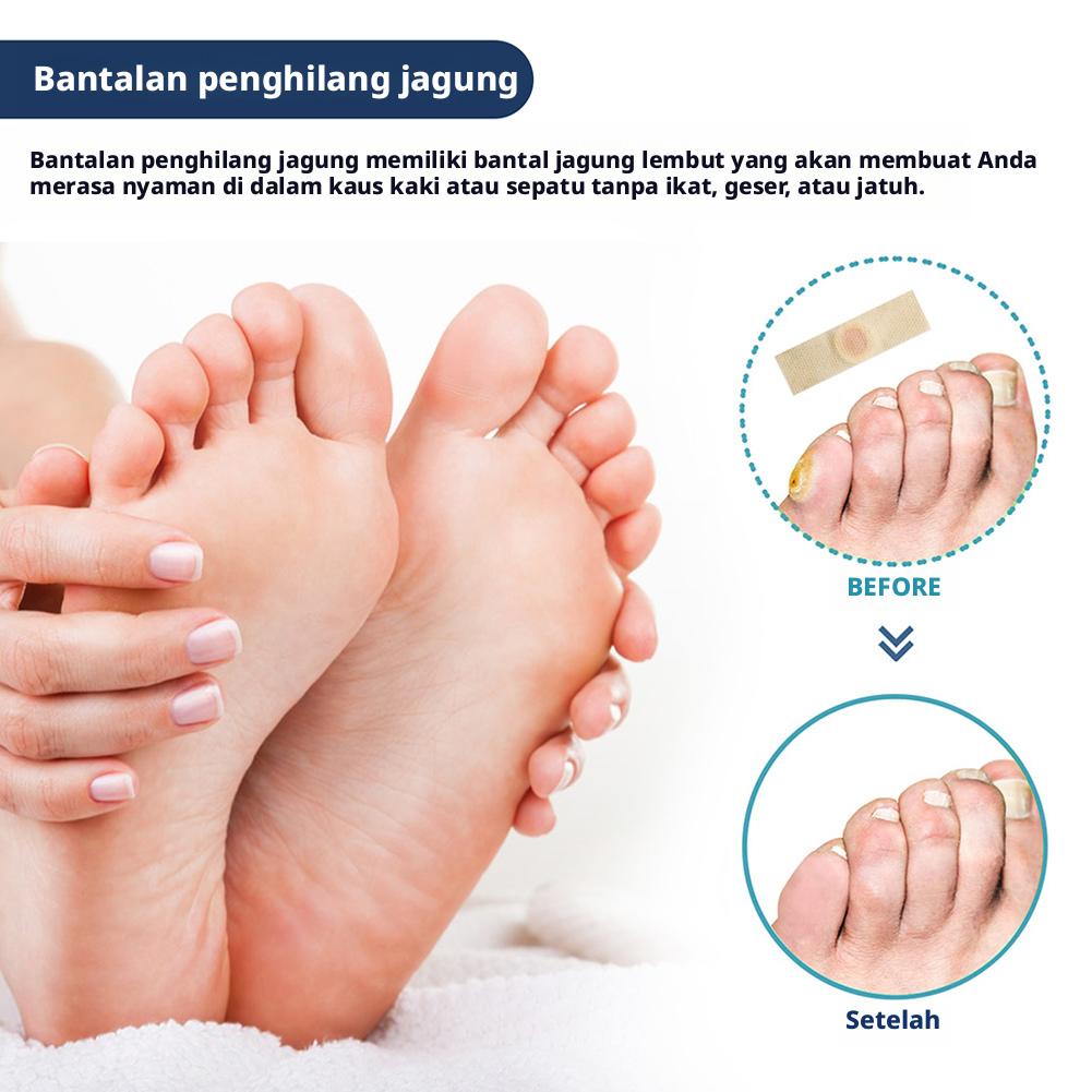 24PCS/box Corn Patch Corn Plaster Remover Corn Toe Pads Patch Adhesive Callus Cushion Non-woven Fabric Toe Corn Callus Removal