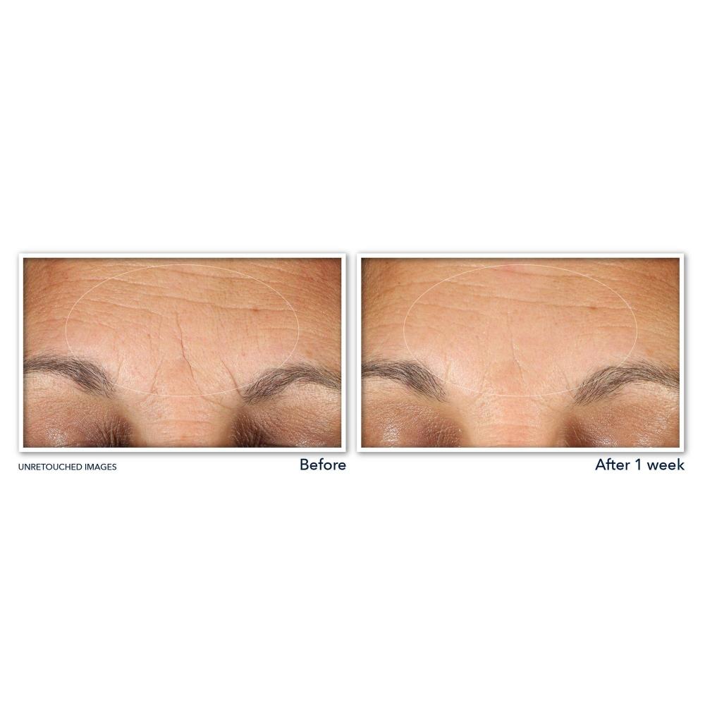 Roc Multi Correxion Hydrate + Plump Hyaluronic Acid Eye Cream 0.5 Oz