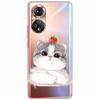 Clear Soft TPU Cover For Honor 50 Pro Lite Case Honor70 5G New Silicone Transparent Funda for Huawei Honor 70 5G Honor50 Coque