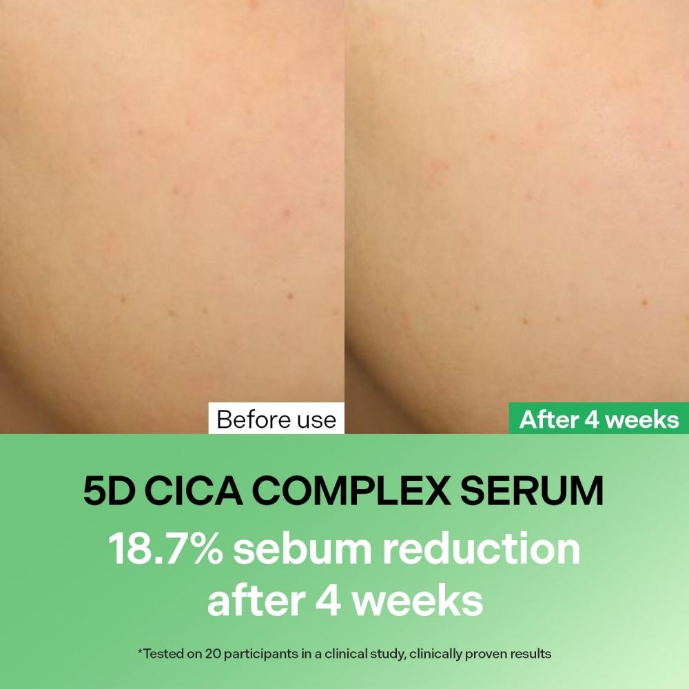 Torriden Balanceful 5d Cica Complex Redness Reducing Serum 1.69 Oz 50 Ml