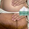 Těhotná žena strie Repair Cream Poporodní opravy a vyblednutí strií