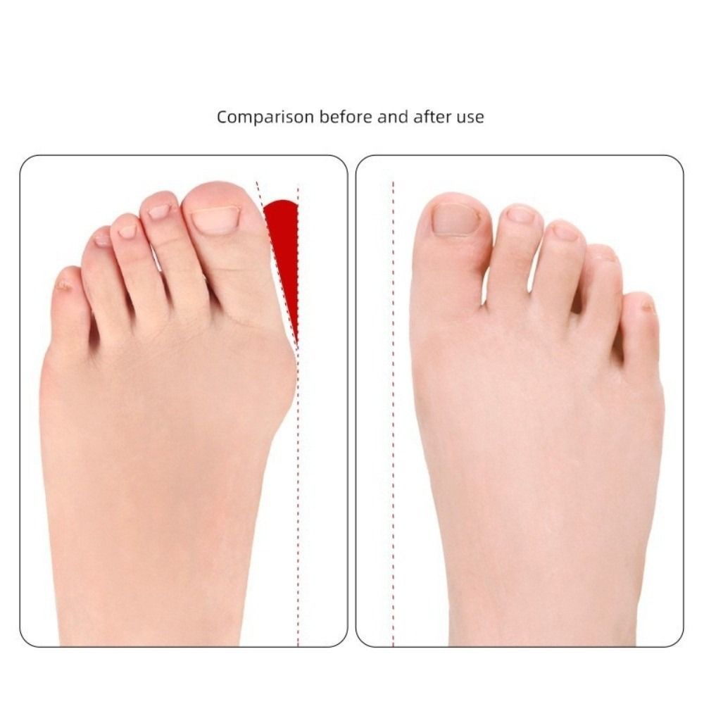 Soft Toe Training Band Washable Toe Stretcher Training Tool Bendable Toe Band  Toe Stretching