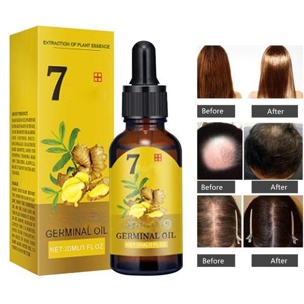 Ingwer-Haarwachstumsprodukte, schnell wachsendes Haar, ätherisches Öl, natürlich, gegen Haarausfall, verhindern trockenes, krauses, beschädigtes Haar, Reparaturpflege