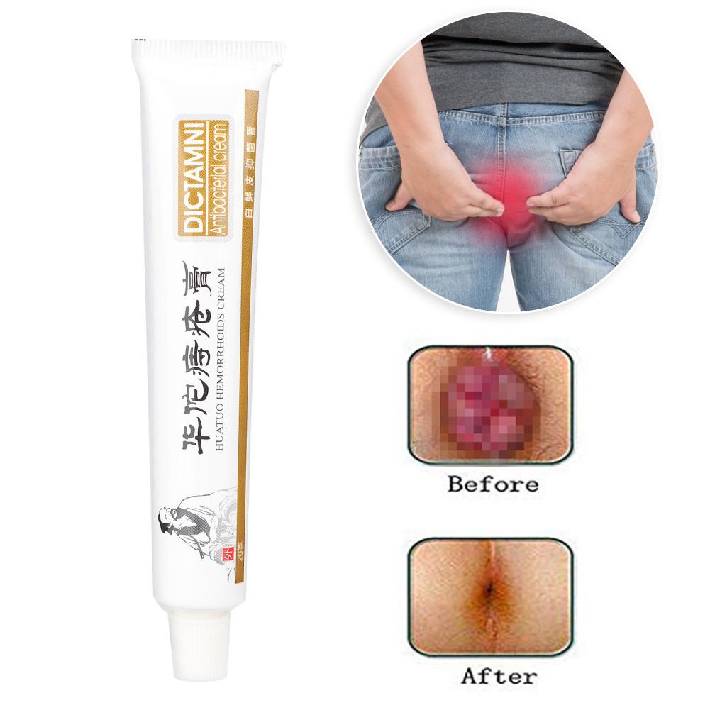 20g Herbal Hemorrhoids Ointment Natural Plant Extract Piles Treatment Cream Relieving Itching