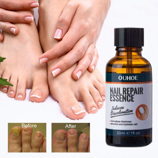 

30 мл унисекс-эссенция для ногтей Gentle Healthy Finger Toe Pedicure Care