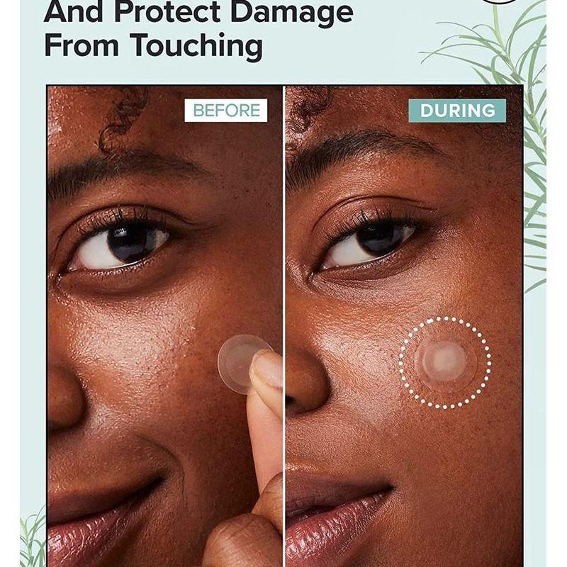 I DEW CARE - Timeout Blemish Patch - 4 Types