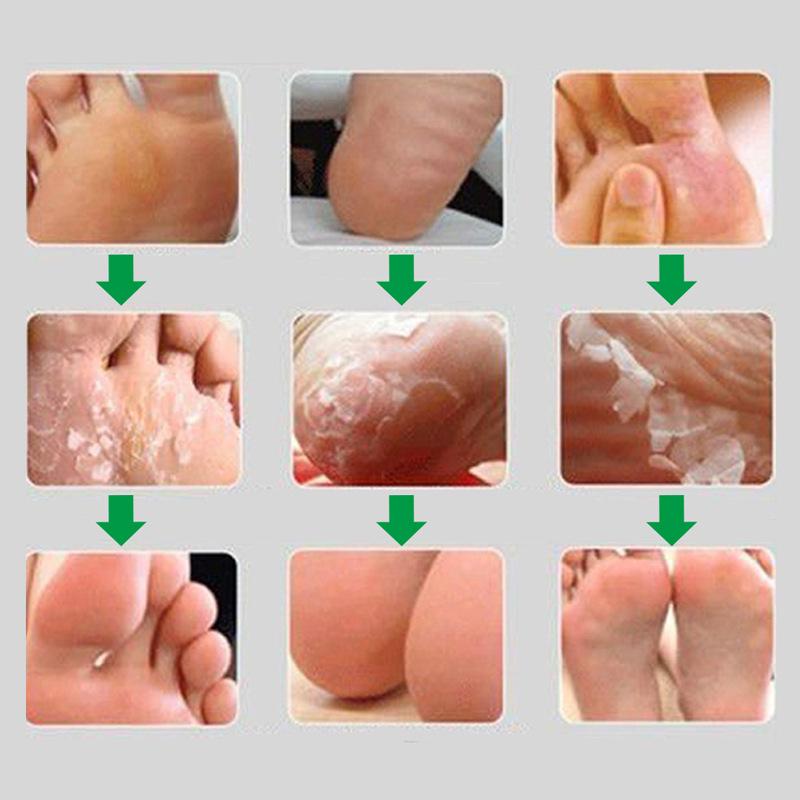 Exfoliating Feet Mask Socks Remover Feet Peel Mask For Foot Mask Care