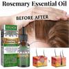 Rosemary Hair Oil For Hair Growth, Essential Oil, Strengthens Hair, Nourishes Scalp, Premium Therapeutic Grade With Dropper - PR