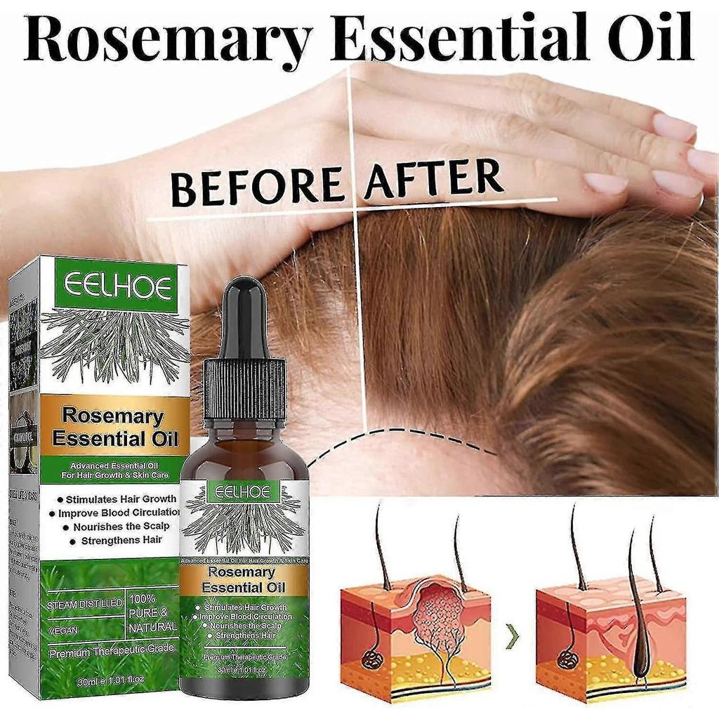 Rosemary Hair Oil For Hair Growth, Essential Oil, Strengthens Hair, Nourishes Scalp, Premium Therapeutic Grade With Dropper - PR