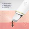 Ultrasonic Skin Scrubber & Microcurrent Color Light Therapy Device for Blackhead Removal & Dead Skin Cleansing
