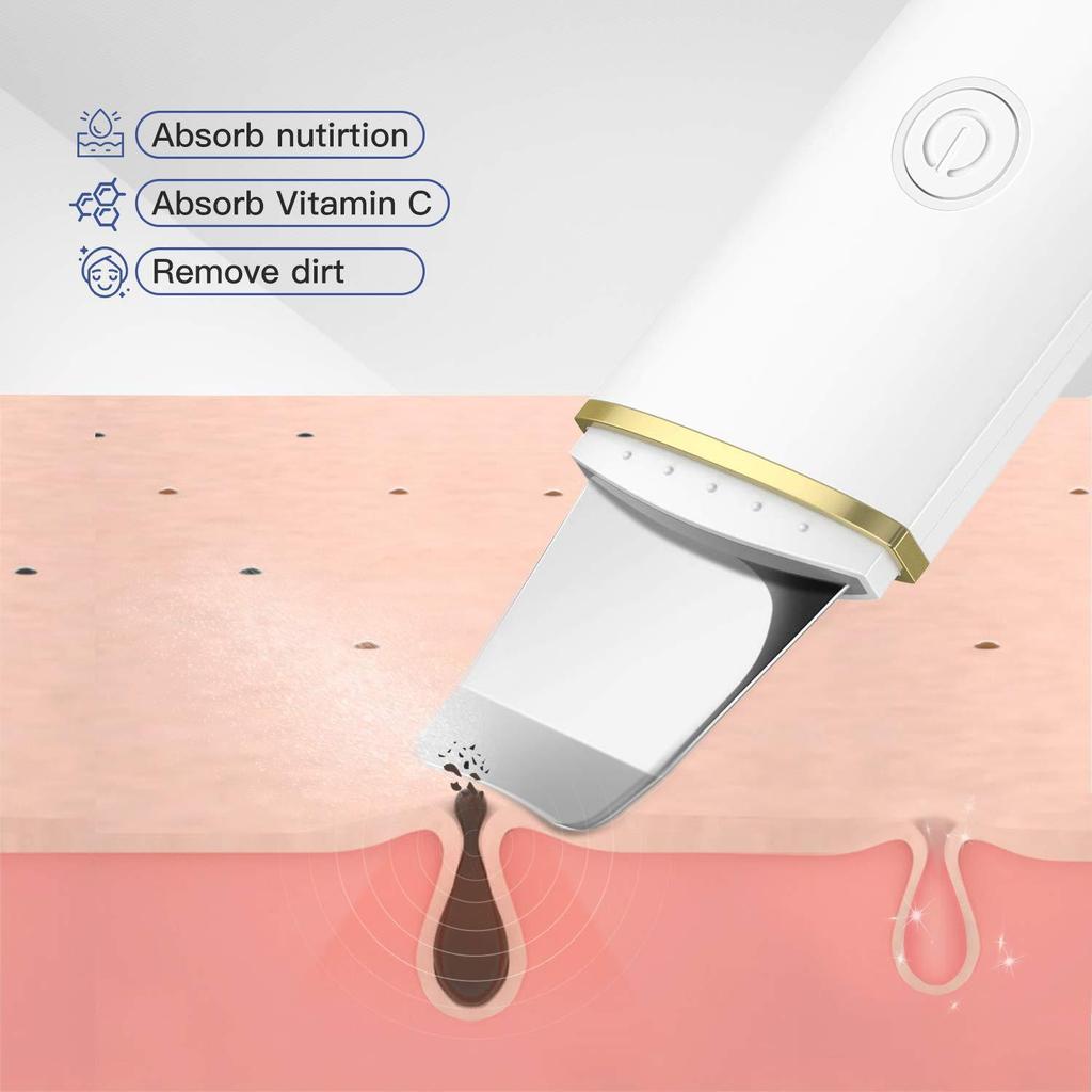 Ultrasonic Skin Scrubber & Microcurrent Color Light Therapy Device for Blackhead Removal & Dead Skin Cleansing