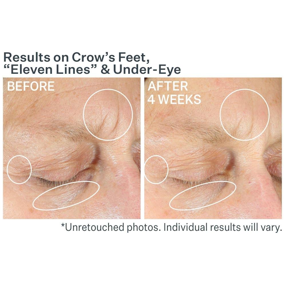 Strivectin Intensive Eye Concentrate For Wrinkles Plus 1.0 Oz