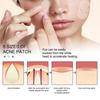 80Pcs/Set Acne Patches With Oil Ultra Thin Pimple Patch Acne Patch