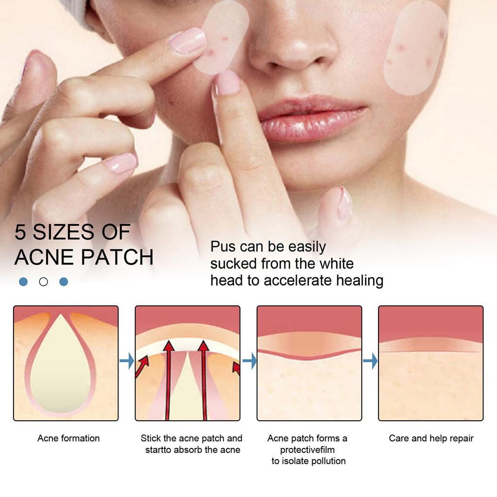 80Pcs/Set Acne Patches With Oil Ultra Thin Pimple Patch Acne Patch