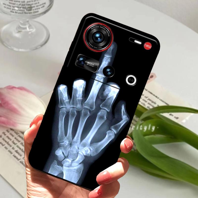 For ZTE Nubia Z70 Ultra 5G Case NX733J Shockproof Soft TPU Silicone Phone Cover For ZTE Nubia Z60S Pro 5G Z50S Pro Bumper Fundas