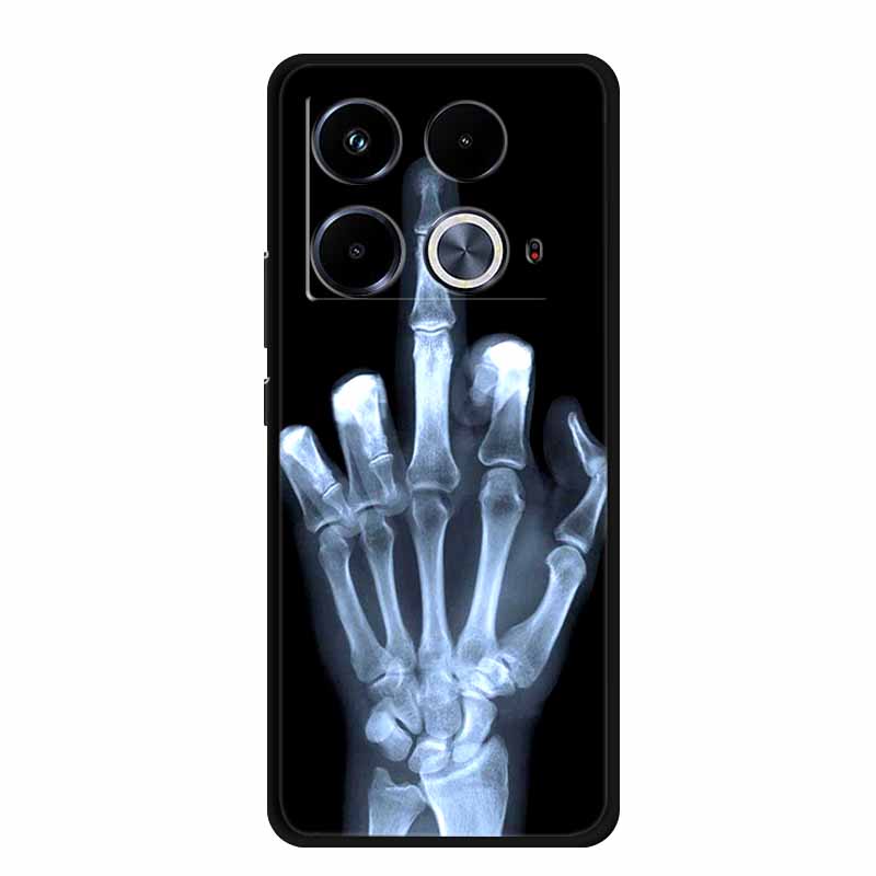Für Infinix Note 40 Pro Hülle 4G 5G Mode Weiches Silikon TPU Rückseite Für Infinix Note 40 4G Handyhülle Coque Note40 Pro 5G