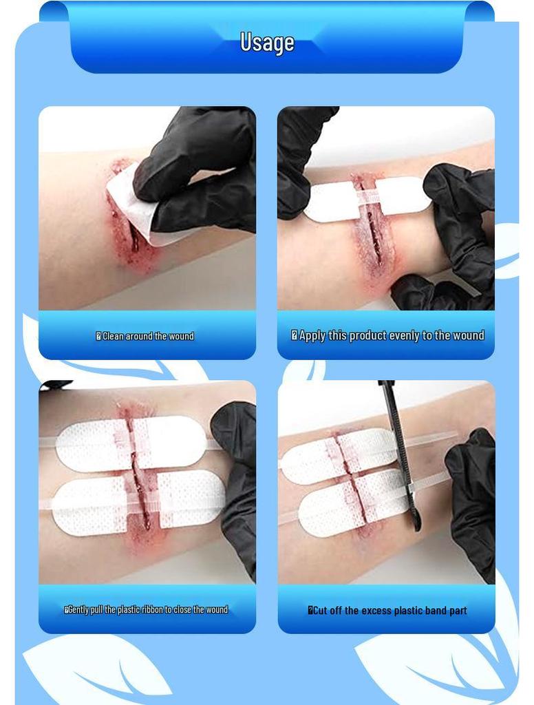 Zippered Suture-Free Tape Closure with Waterproof Patch