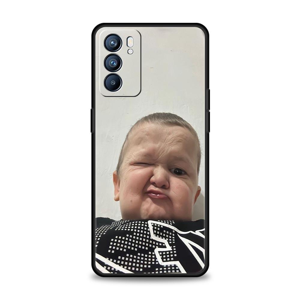 Funny Hasbulla Phone Case For Oppo Reno8 Reno7 Reno6 Pro A54 5G Find X6 X5 A53 A52 A9 A15 A95 A17 A16 A76 A74 A57 A31 Cover