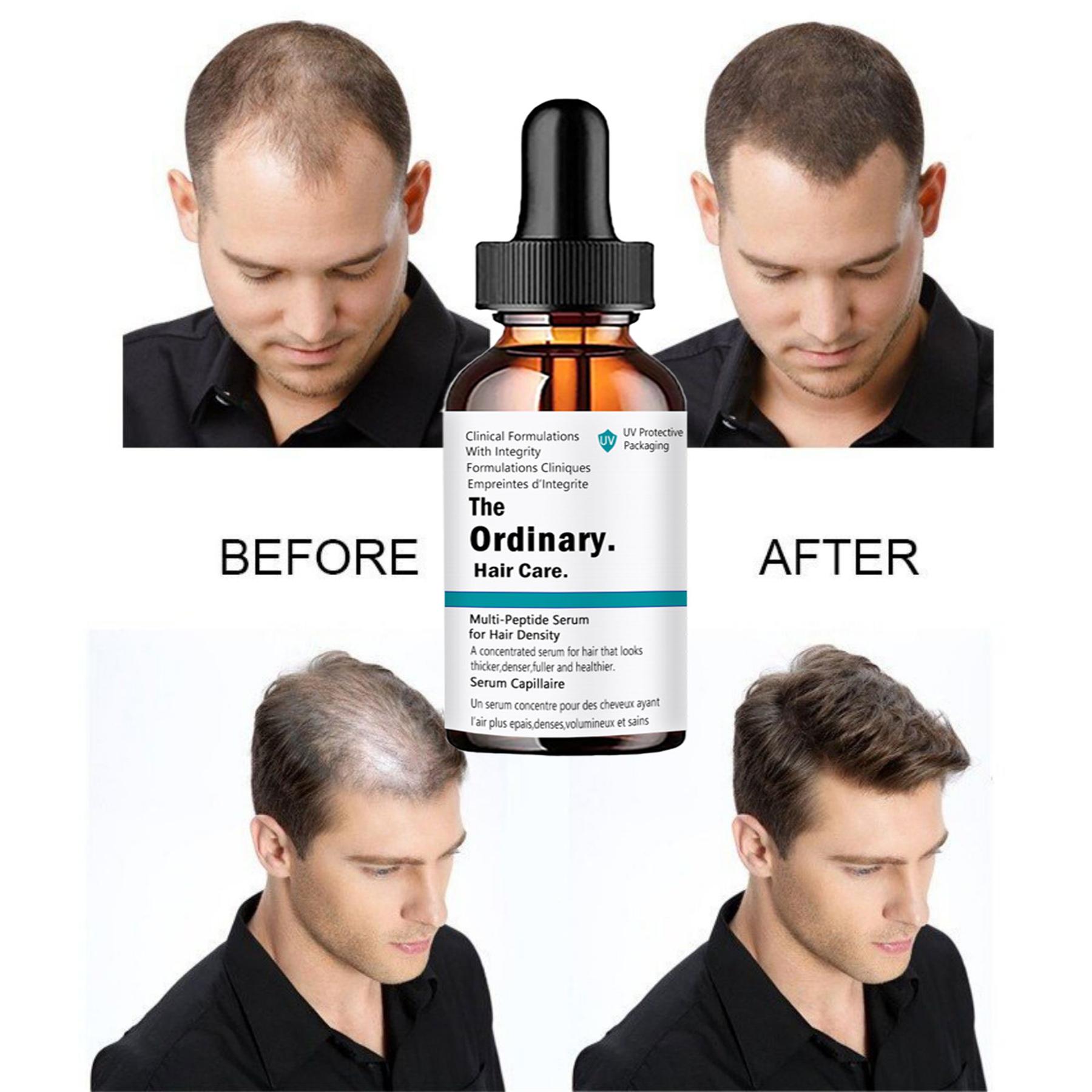 

Профессиональный уход за волосами Увлажняющая и питательная маска для истонченных волос